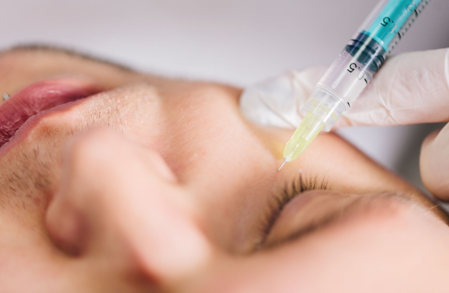 profhilo stymulator tkankowy