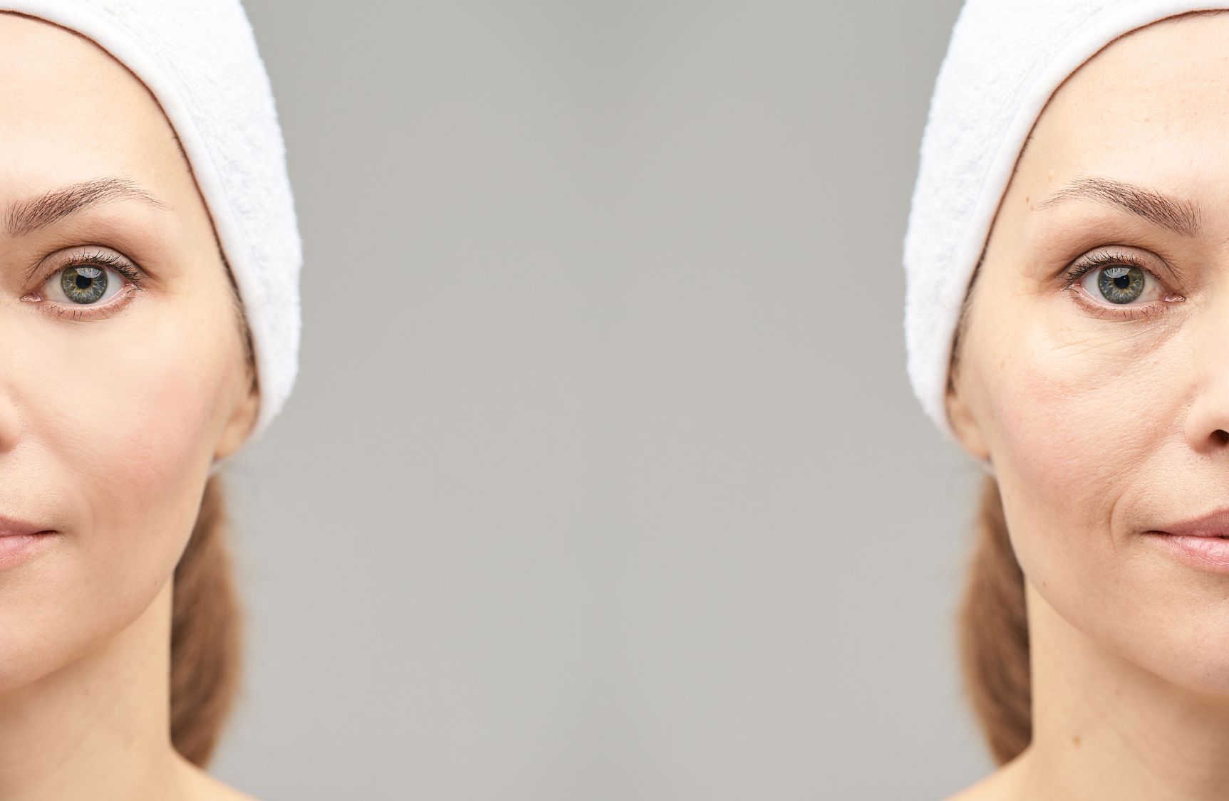 lifting bez skalpela - nieablacyjne odmładzanie