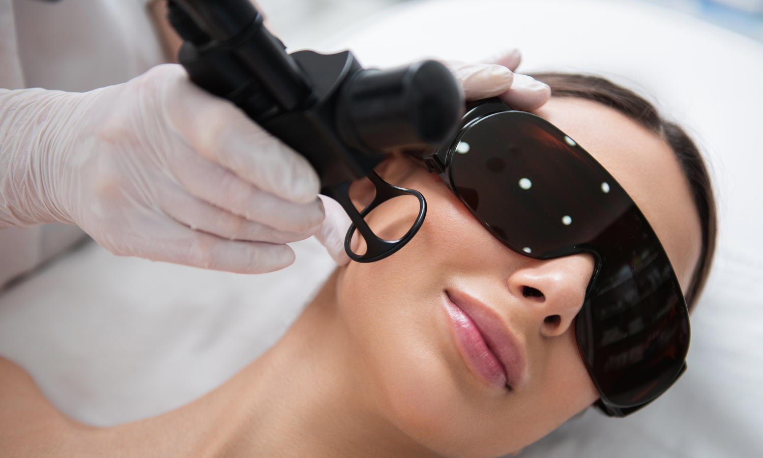 laserowe odmładzanie zimą