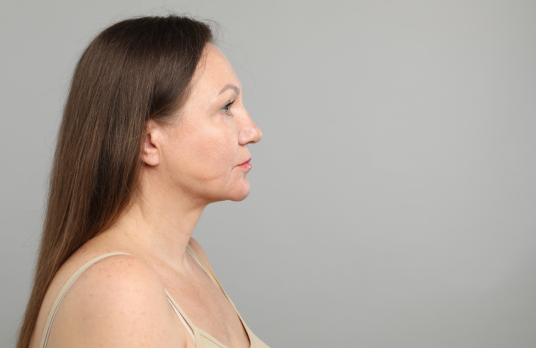 Lifting twarzy bez skalpela - jakie zabiegi dają naturalny efekt napięcia skóry?