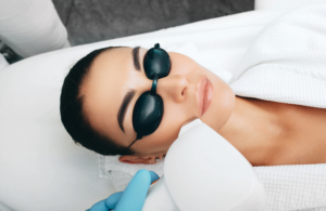 Depilacja laserowa twarzy a trądzik różowaty - czy to bezpieczne połączenie?