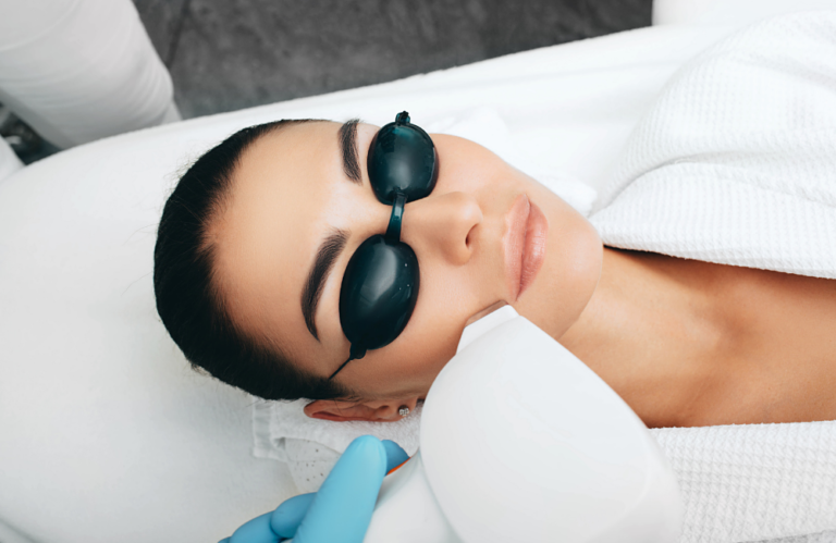 Depilacja laserowa twarzy a trądzik różowaty - czy to bezpieczne połączenie?